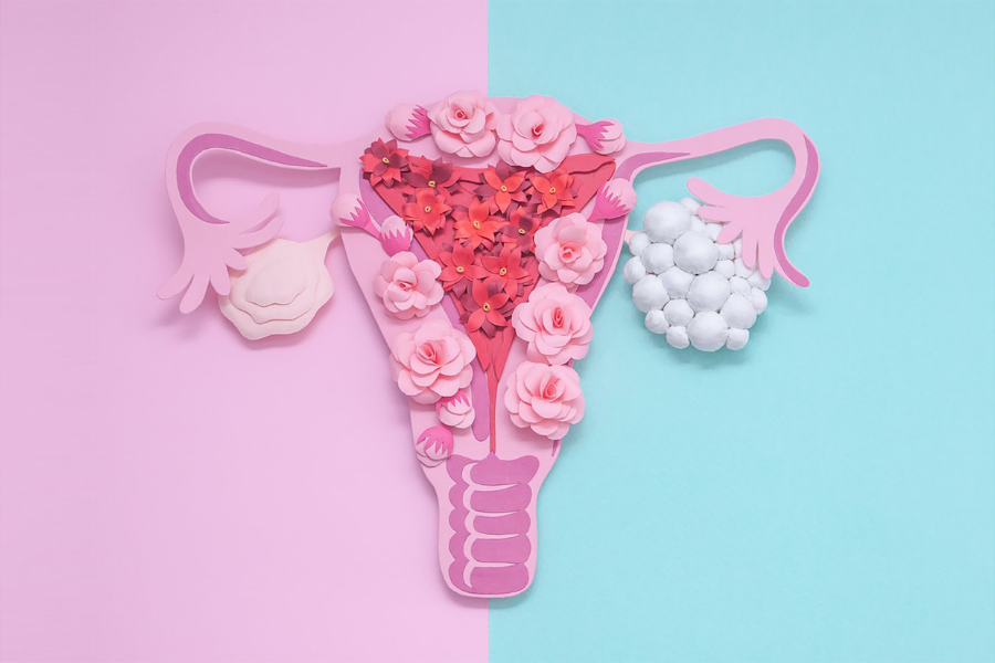 Online Symposia PCOS